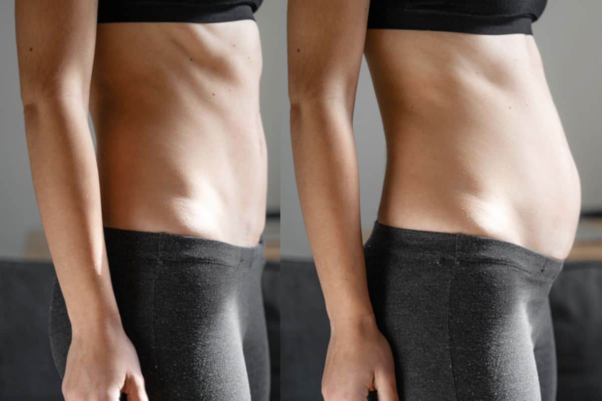 How long does diastasis recti take to improve Ryton-on-Dunsmore?