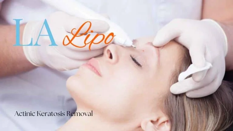 Woman receiving Actinic Keratosis Removal Treatment Ryton-on-Dunsmore