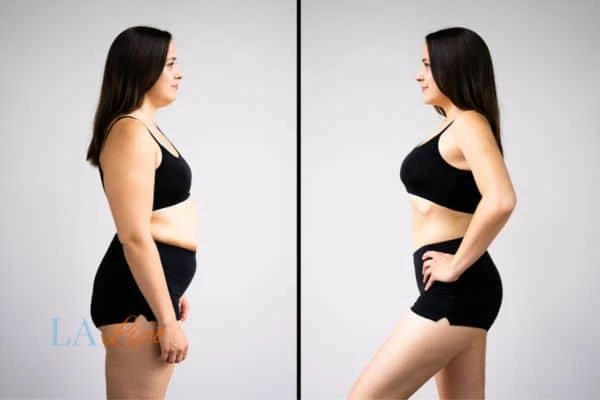 LA-EMS Body Sculpting Ryton-on-Dunsmore results before and after of womans results on body toning.