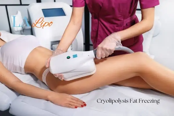 Woman receiving coolsculpting Ryton-on-Dunsmore treatment on her thighs