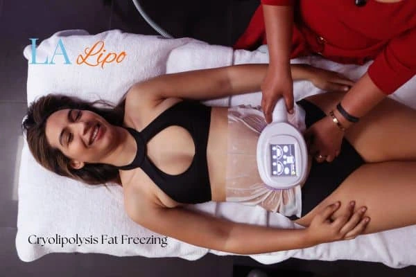 woman getting cryolipolysis Ryton-on-Dunsmore
