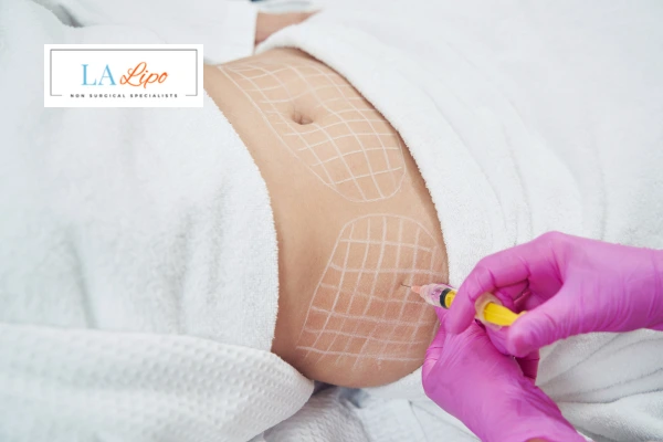 aqualyx fat dissolving injections Ryton-on-Dunsmore