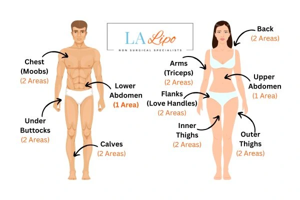 LA LIPO Cryolipolysis Areas Ryton-on-Dunsmore