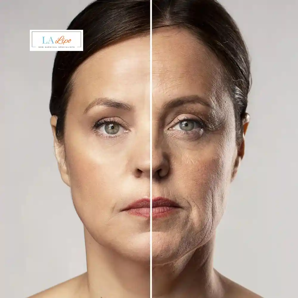 How Can You Tell If Non-Surgical Skin Tightening Is Right for You Ryton-on-Dunsmore?