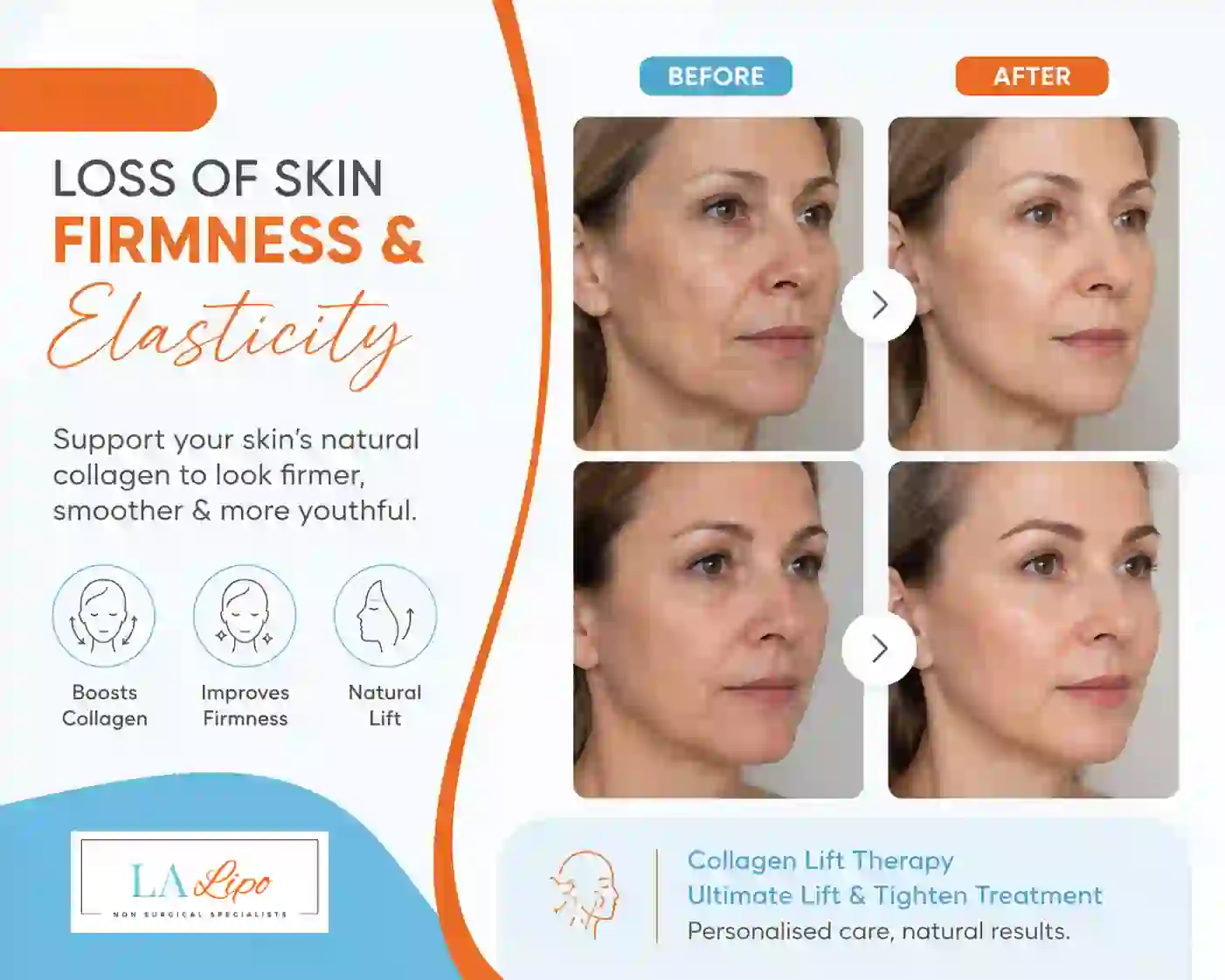 Sign #7: Loss of Skin Firmness and Elasticity Ryton-on-Dunsmore